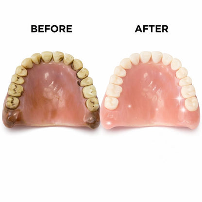Denture Cleaner  UV